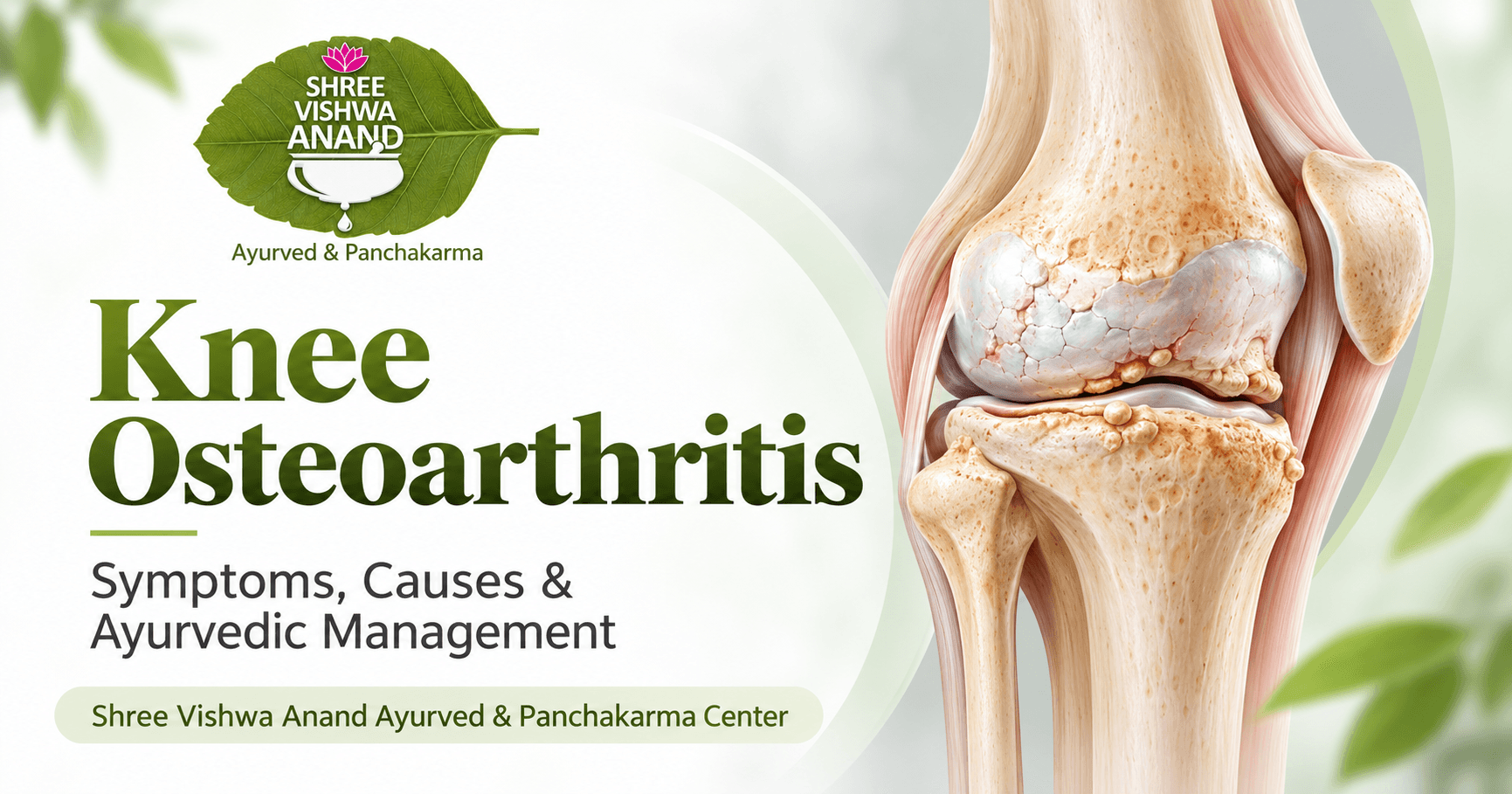 Illustrated cover image for an article about knee osteoarthritis.