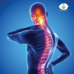 Spondylitis