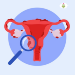 Gynaecological Disorders